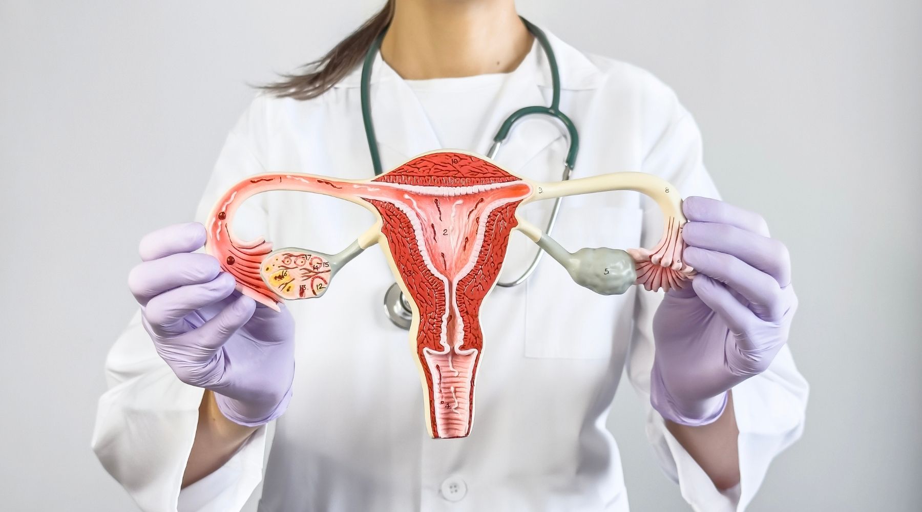 Polikistik Over Sendromu